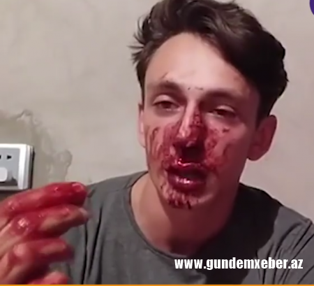 Vətəndaşa yumruqla zərbələr endirən şəxsin kimliyi bəlli oldu