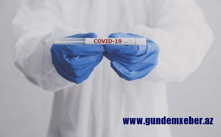 Rusiya indiyədək Azərbaycana 12 min COVID-19 testi göndərib