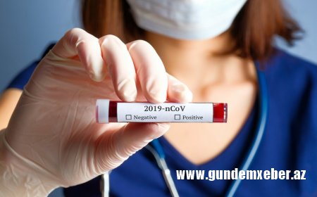 Gürcüstanda 4 666 tibb işçisi koronavirusa yoluxub