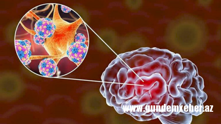Koronavirus uzun müddət beyin və bağırsaqlarda qalır - Alimlər