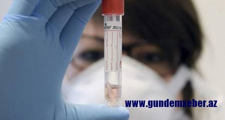 Koronavirus kimlər üçün daha çox təhlükəlidir? - Açıqlama