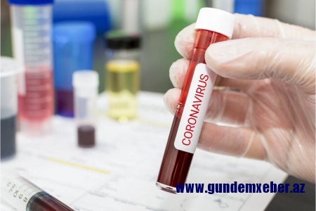 Gürcüstanda son sutkada COVID-19-a 352 yoluxma qeydə alınıb, 9 nəfər ölüb