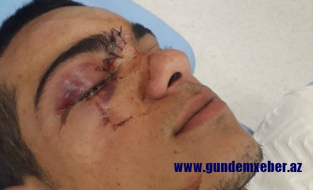 Cəlilabad polisi nə üçün Qazilərimizi döyənləri həbs etmir?!.-İDDİA