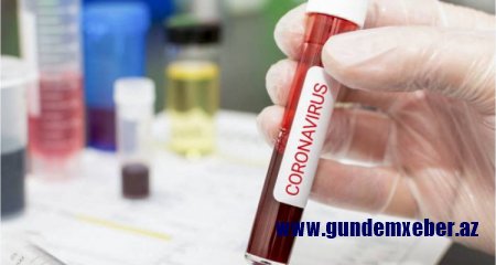 Gürcüstanda son sutkada COVID-19-dan 59 nəfər ölüb