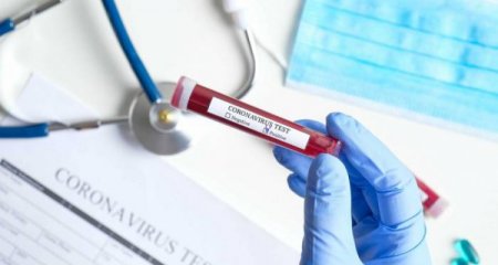 Azərbaycanda daha 25 nəfər koronavirusa yoluxub