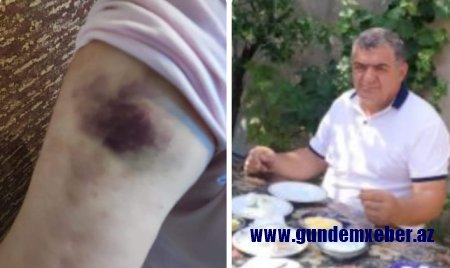 Vəzifəli şəxs qadını döydü - FOTO