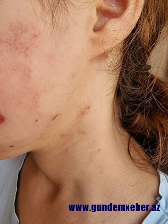 Yeniyetmə qızı döydüyü iddia edilən icra başçısı müavini: “Əxlaqsız videoları vardı” – YENİLƏNİB + FOTO