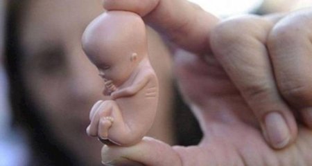 Azərbaycanda abortların sayı rekord həddə çatdı: Məktəbyaşlı qızlar da var – Siyahı
