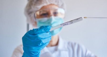 Son sutkada 21 yeni yoluxma faktı qeydə alınıb