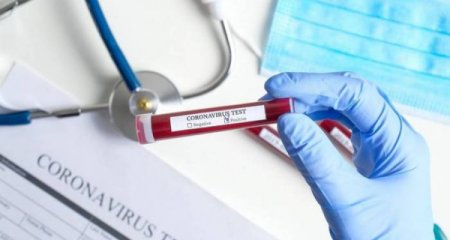 Azərbaycanda koronavirusa yoluxanların sayı açıqlanıb