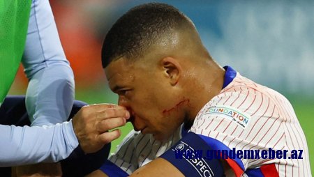Fransa şokda: Mbappe oynamayacaq
