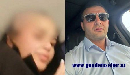 Arvadının saçını keçəl edən ər HƏBS OLUNDU