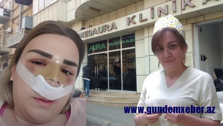 Ölüm saçan “MedAura” klinikası – Uğursuz əməliyyatlara səbəb olan Nigar Məhəmmədova iş başındadır? -DETALLAR